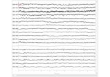 Setting the EEG reference