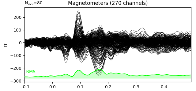 Magnetometers (270 channels)