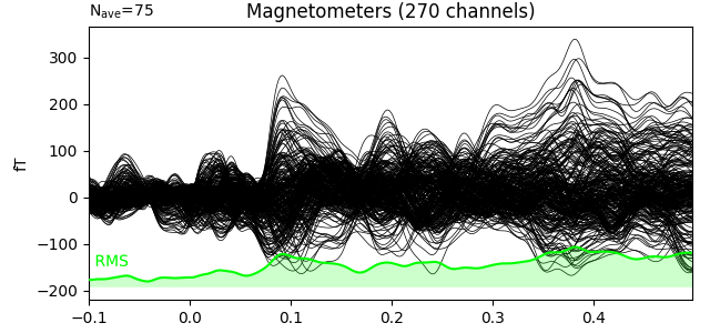 Magnetometers (270 channels)