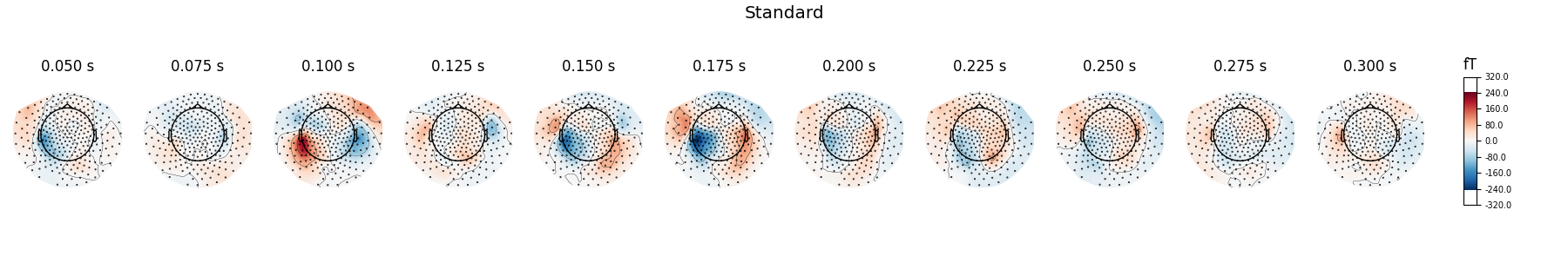 Standard, 0.050 s, 0.075 s, 0.100 s, 0.125 s, 0.150 s, 0.175 s, 0.200 s, 0.225 s, 0.250 s, 0.275 s, 0.300 s, fT