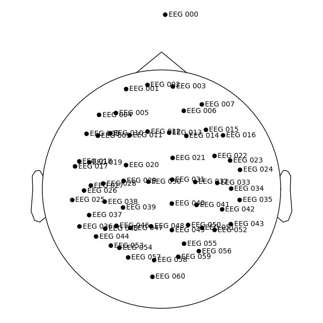 70 eeg mri coords