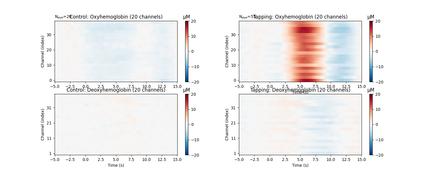 Control: Oxyhemoglobin (20 channels), Tapping: Oxyhemoglobin (20 channels), Control: Deoxyhemoglobin (20 channels), Tapping: Deoxyhemoglobin (20 channels), µM, µM, µM, µM