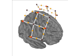 Preprocessing functional near-infrared spectroscopy (fNIRS) data