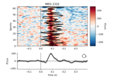 Visualize channel over epochs as an image