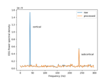 Cortical Signal Suppression (CSS) for removal of cortical signals