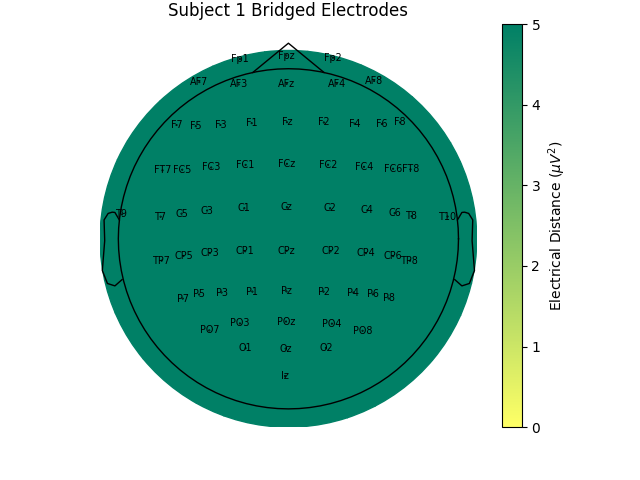 Subject 1 Bridged Electrodes