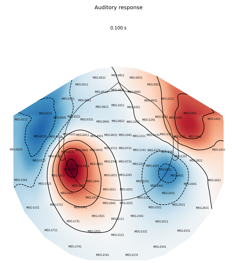 Auditory response, 0.100 s