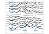 Visualise NIRS artifact correction methods