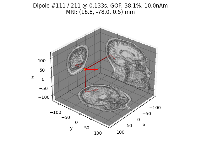 Dipole #111 / 211 @ 0.133s, GOF: 38.1%, 10.0nAm MRI: (16.8, -78.0, 0.5) mm