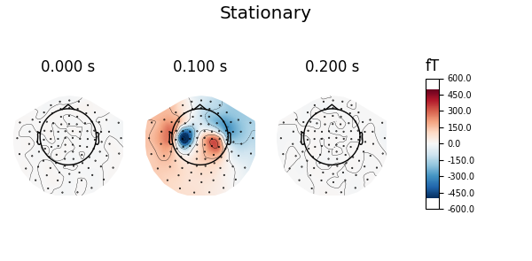 Stationary, 0.000 s, 0.100 s, 0.200 s, fT