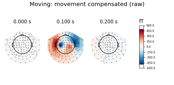 Moving: movement compensated (raw), 0.000 s, 0.100 s, 0.200 s, fT