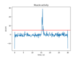 Annotate muscle artifacts