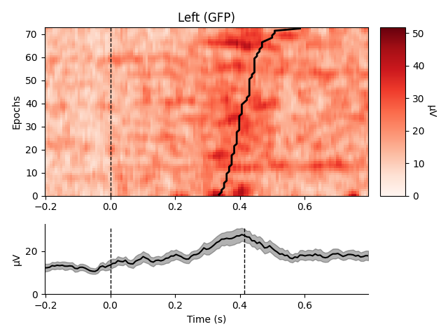 Left (GFP)