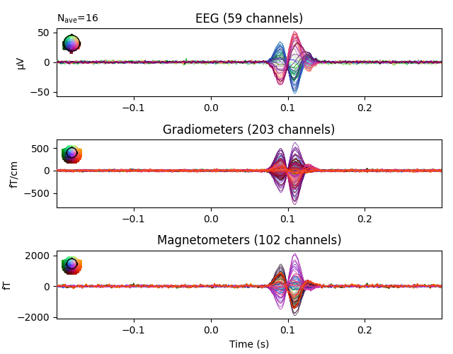 EEG (59 channels), Gradiometers (203 channels), Magnetometers (102 channels)