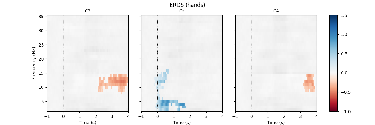 ERDS (hands), C3, Cz, C4