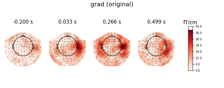 grad (original), -0.200 s, 0.033 s, 0.266 s, 0.499 s, fT/cm