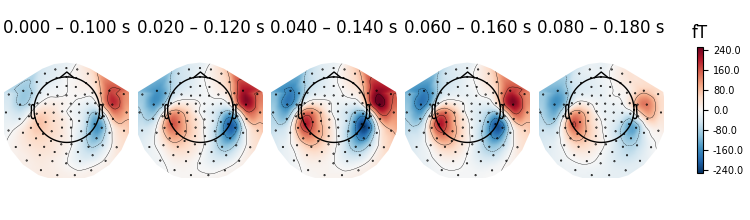0.000 – 0.100 s, 0.020 – 0.120 s, 0.040 – 0.140 s, 0.060 – 0.160 s, 0.080 – 0.180 s, fT