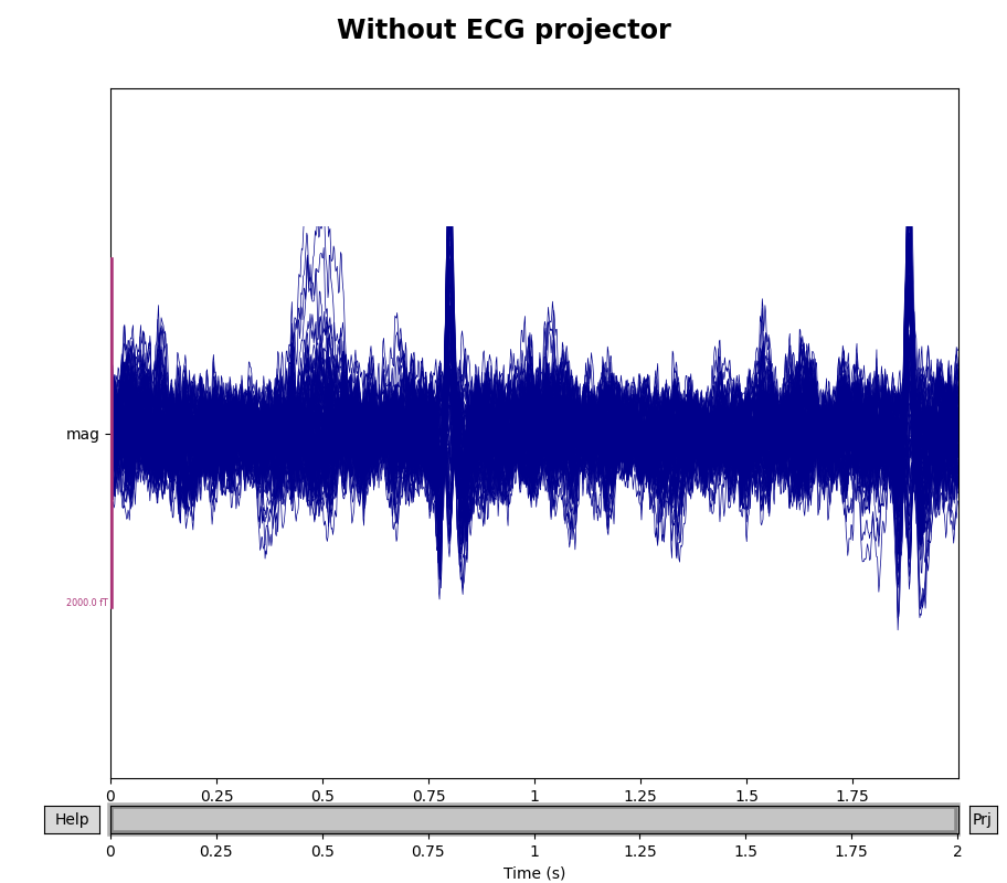 Without ECG projector