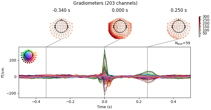 Gradiometers (203 channels), -0.340 s, 0.000 s, 0.250 s