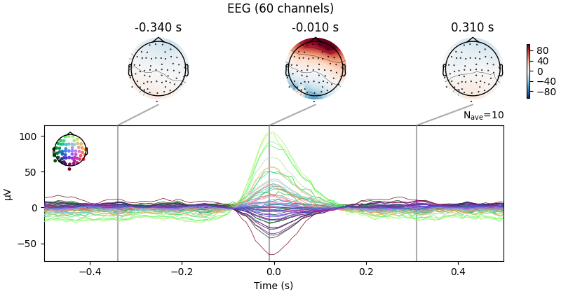 EEG (60 channels), -0.340 s, -0.010 s, 0.310 s