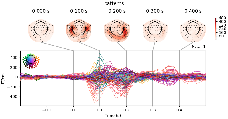 patterns, 0.000 s, 0.100 s, 0.200 s, 0.300 s, 0.400 s