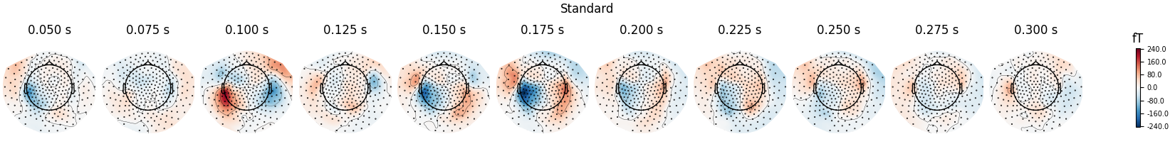Standard, 0.050 s, 0.075 s, 0.100 s, 0.125 s, 0.150 s, 0.175 s, 0.200 s, 0.225 s, 0.250 s, 0.275 s, 0.300 s, fT