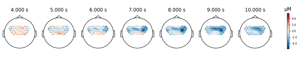4.000 s, 5.000 s, 6.000 s, 7.000 s, 8.000 s, 9.000 s, 10.000 s, µM