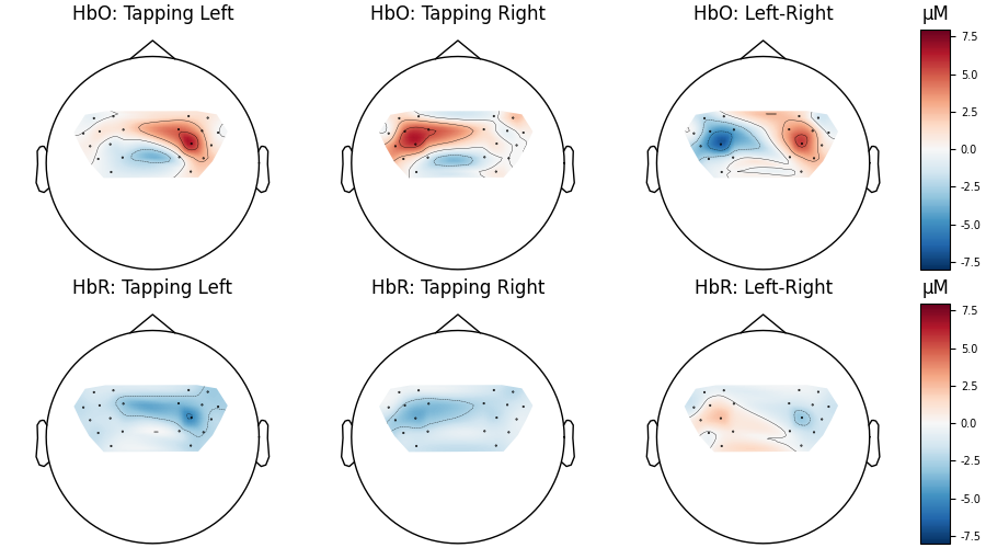HbO: Tapping Left, HbO: Tapping Right, HbO: Left-Right, µM, HbR: Tapping Left, HbR: Tapping Right, HbR: Left-Right, µM