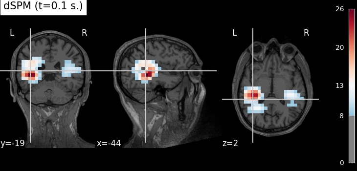 compute mne inverse volume