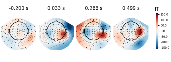 -0.200 s, 0.033 s, 0.266 s, 0.499 s, fT