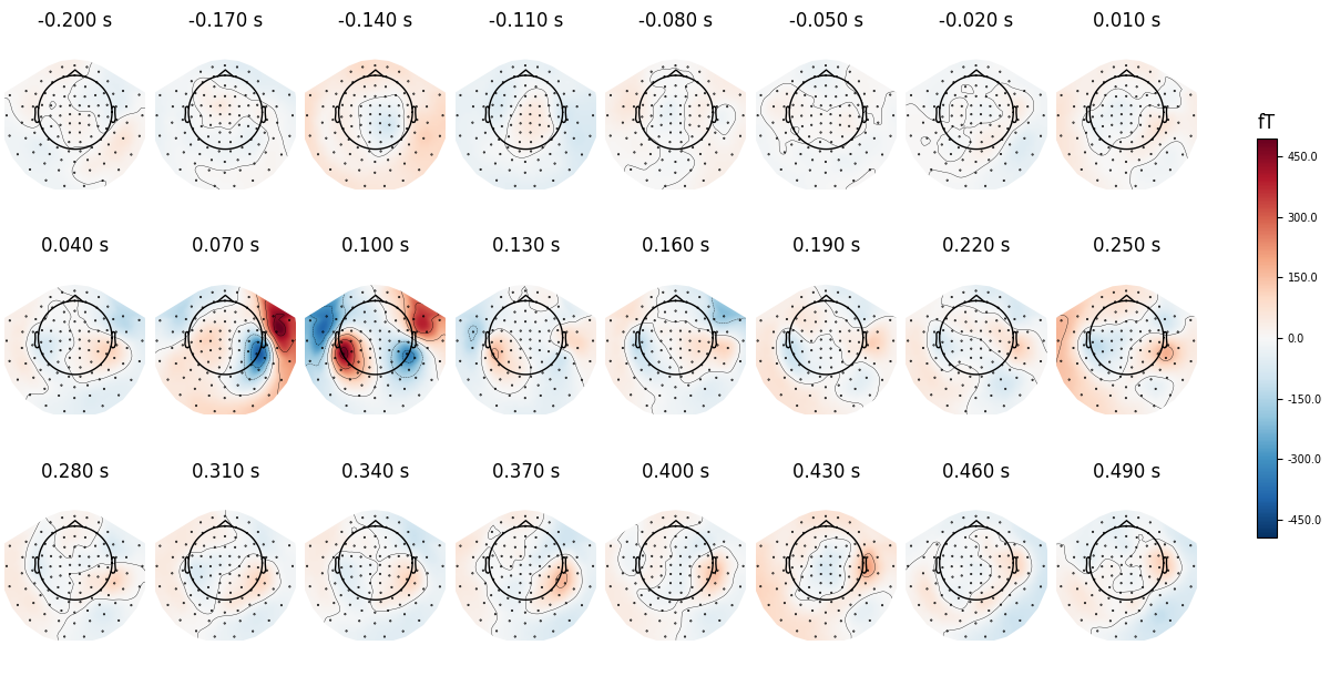 -0.200 s, -0.170 s, -0.140 s, -0.110 s, -0.080 s, -0.050 s, -0.020 s, 0.010 s, 0.040 s, 0.070 s, 0.100 s, 0.130 s, 0.160 s, 0.190 s, 0.220 s, 0.250 s, 0.280 s, 0.310 s, 0.340 s, 0.370 s, 0.400 s, 0.430 s, 0.460 s, 0.490 s, fT
