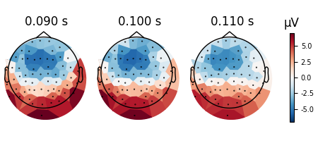 0.090 s, 0.100 s, 0.110 s, µV