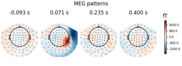 MEG patterns, -0.093 s, 0.071 s, 0.235 s, 0.400 s, fT