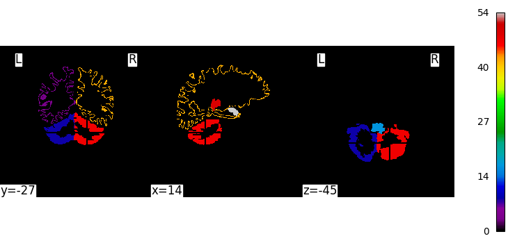 mixed source space inverse