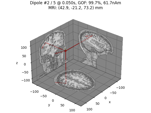 Dipole #2 / 5 @ 0.050s, GOF: 99.7%, 61.7nAm MRI: (42.9, -21.2, 73.2) mm