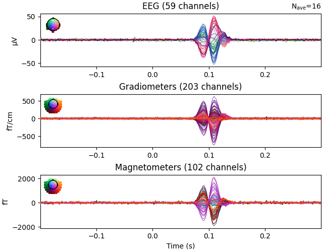 EEG (59 channels), Gradiometers (203 channels), Magnetometers (102 channels)