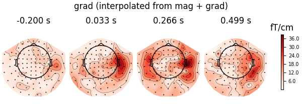 grad (interpolated from mag + grad), -0.200 s, 0.033 s, 0.266 s, 0.499 s, fT/cm