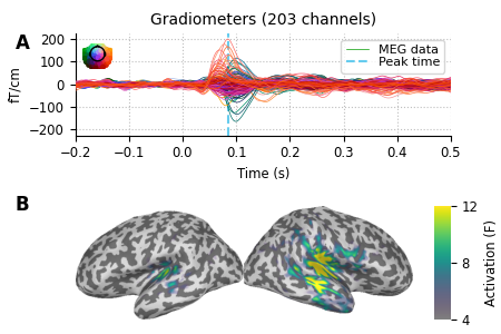 Gradiometers (203 channels)