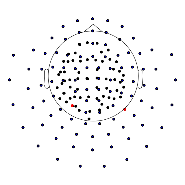 20 visualize epochs