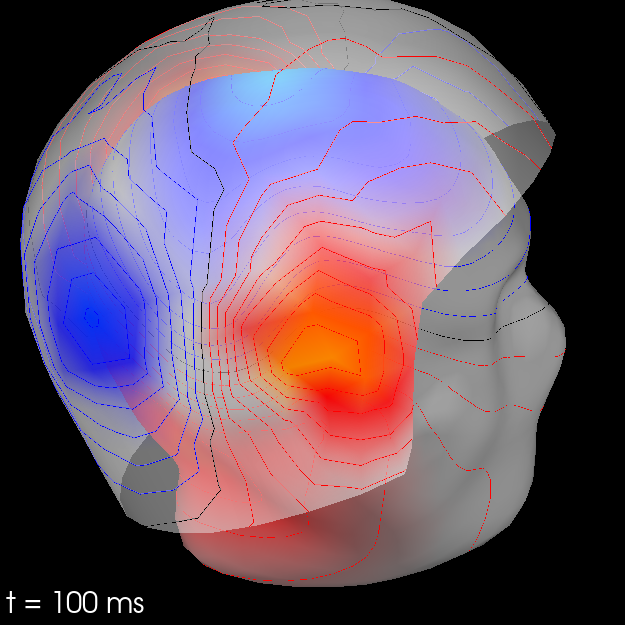 20 visualize evoked