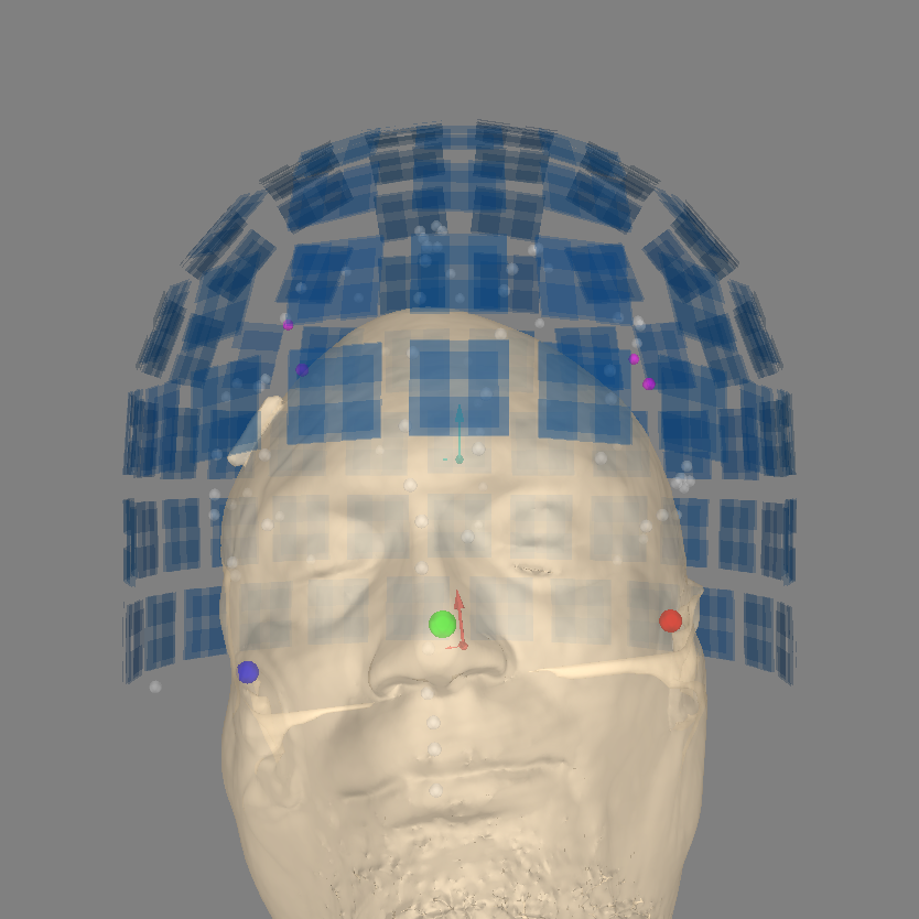 25 automated coreg