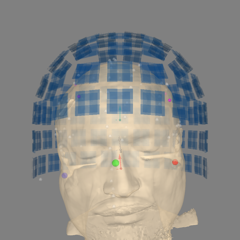 25 automated coreg