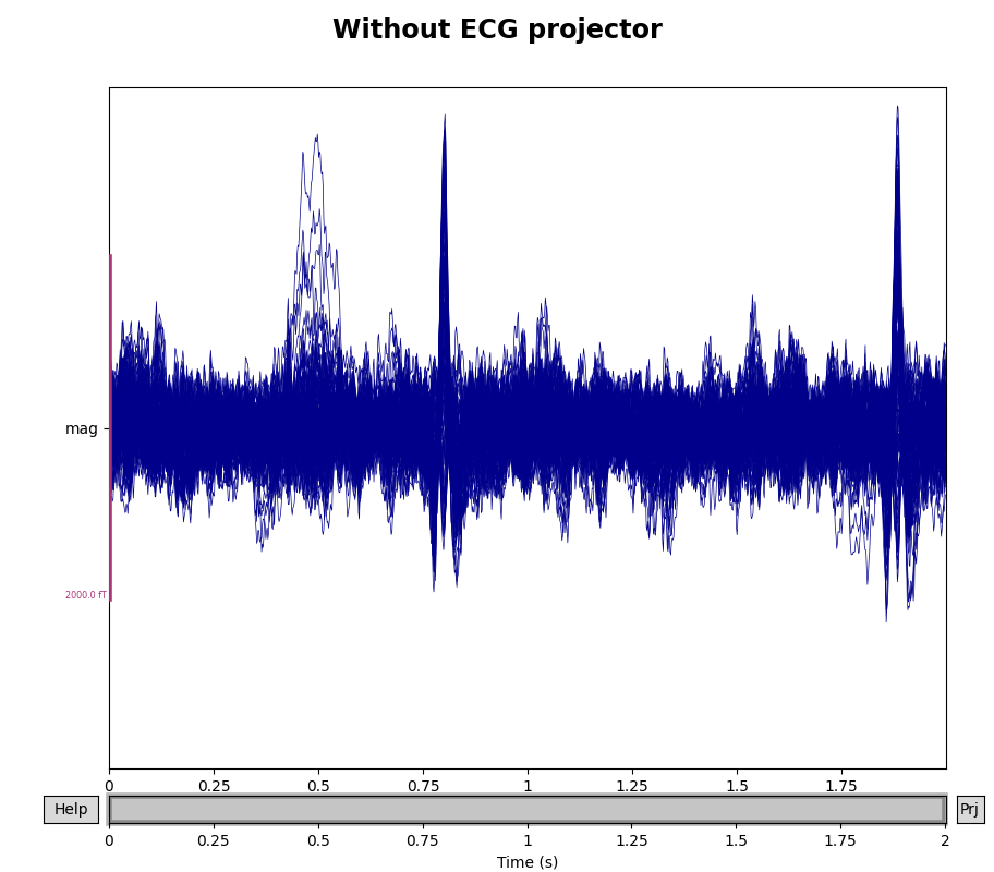 Without ECG projector