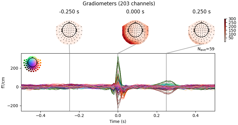 Gradiometers (203 channels), -0.250 s, 0.000 s, 0.250 s