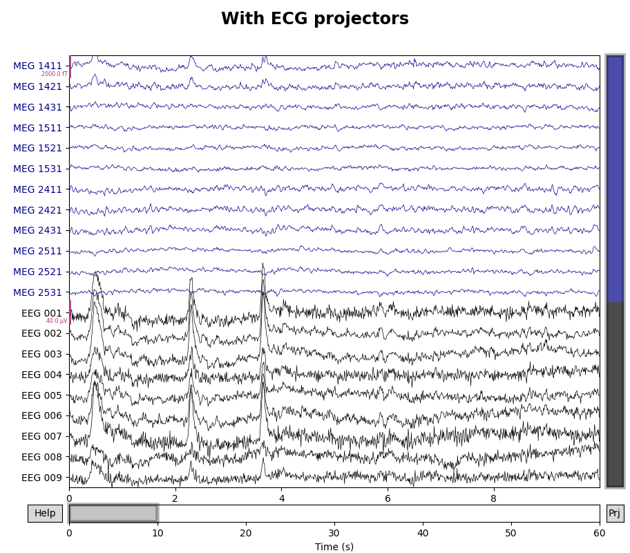 With ECG projectors