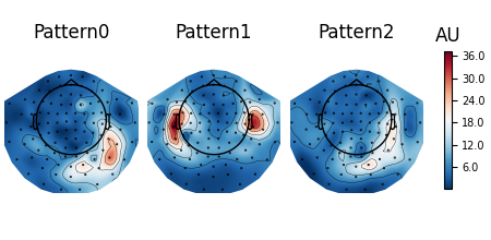 Pattern0, Pattern1, Pattern2, AU