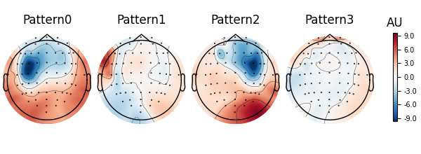 Pattern0, Pattern1, Pattern2, Pattern3, AU