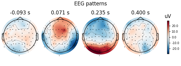 EEG patterns, -0.093 s, 0.071 s, 0.235 s, 0.400 s, uV