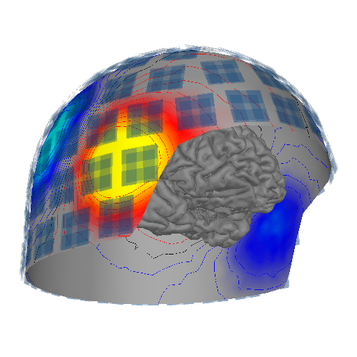 mne helmet