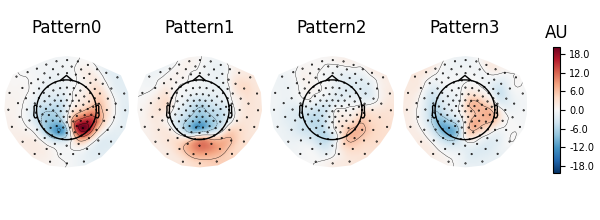 Pattern0, Pattern1, Pattern2, Pattern3, AU